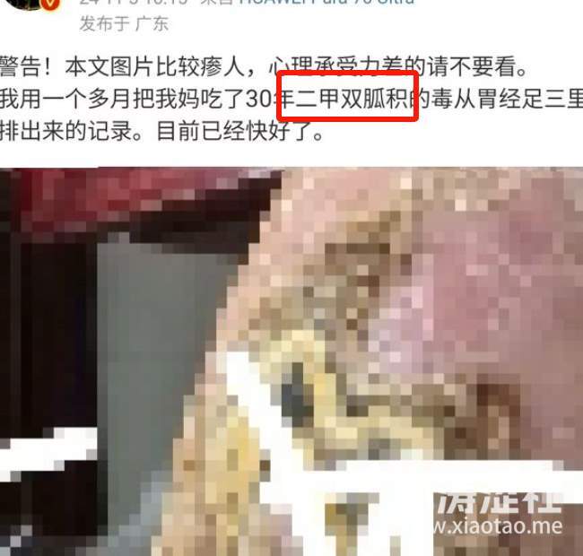 类人生物的多样性！逆天大孝子给糖尿病亲妈停药，排毒治疗...._黑料正能量