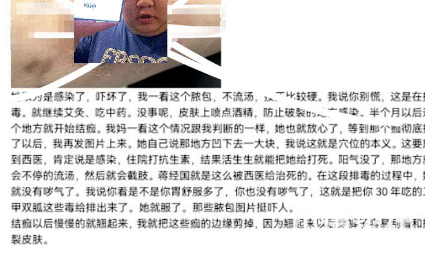 类人生物的多样性！逆天大孝子给糖尿病亲妈停药，排毒治疗...._黑料正能量